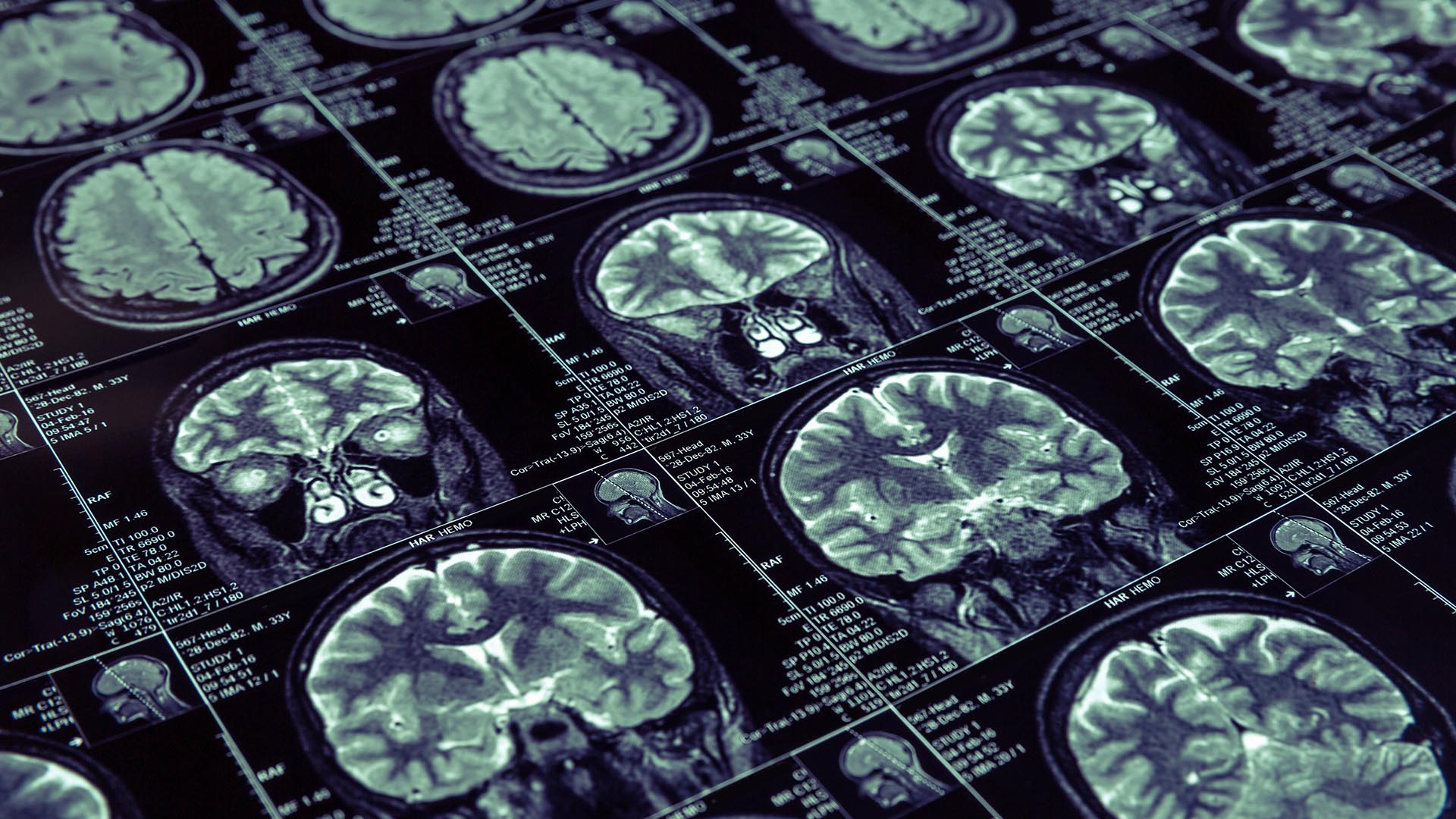 Física Do Radiodiagnóstico Com ênfase Em Tomografia Computadorizada E Medicina Nuclear